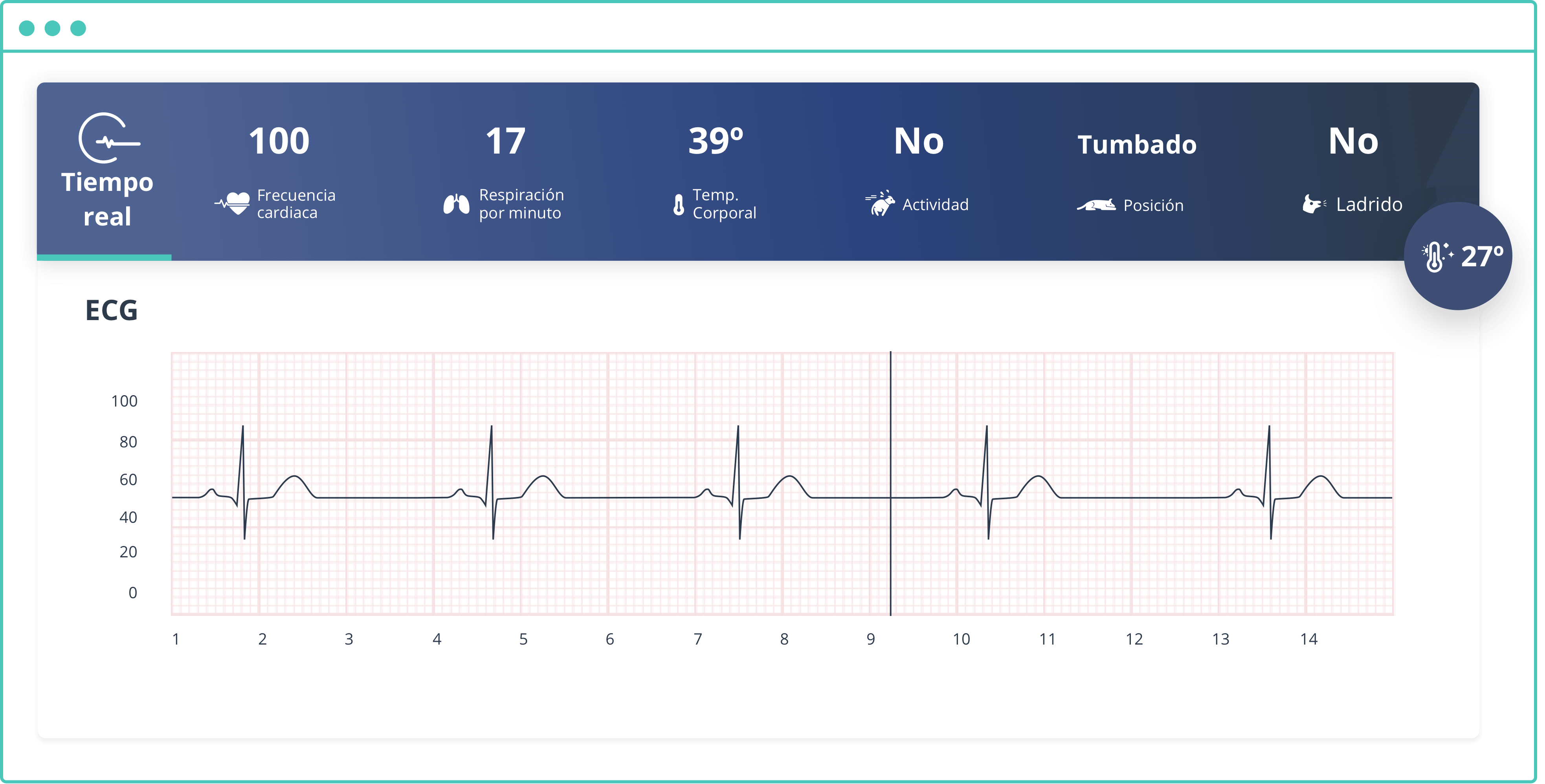 ECG-1.png